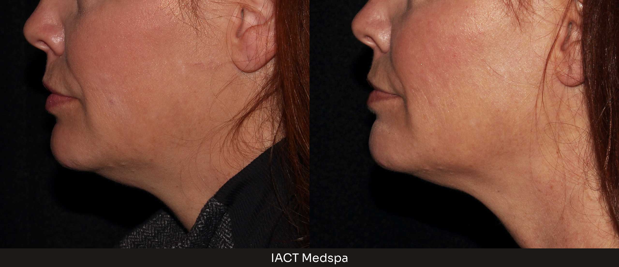 Define Facial Modeling